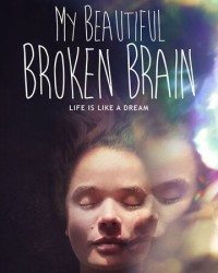 Khối óc xinh đẹp tội nghiệp của tôi (My Beautiful Broken Brain) [2016]